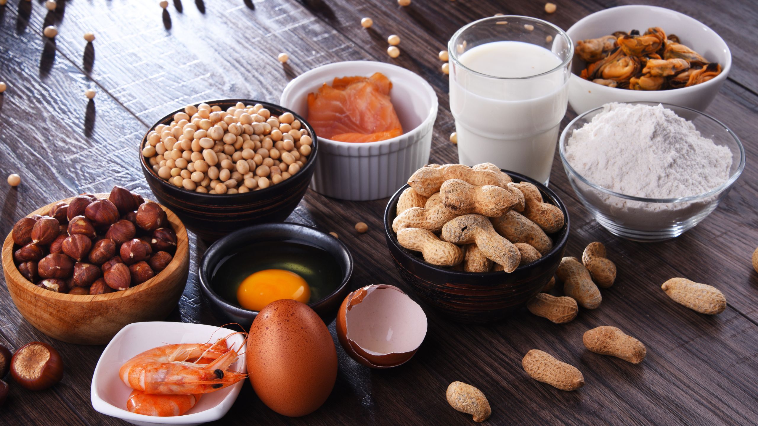A line up of the common foods that a PCQI must monitor as part of their Allergen Controls.